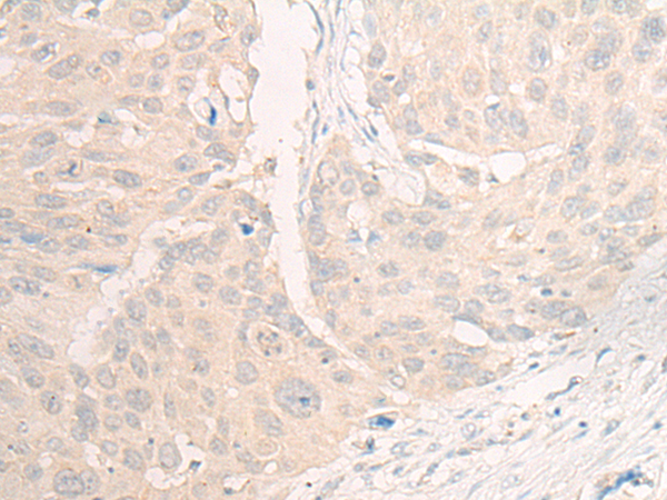 Rabbit Polyclonal Antibody to DHRS4
