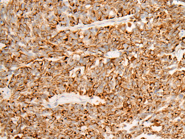 Rabbit Polyclonal Antibody to DIP2B