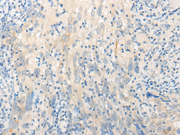 Rabbit Polyclonal Antibody to DISP2