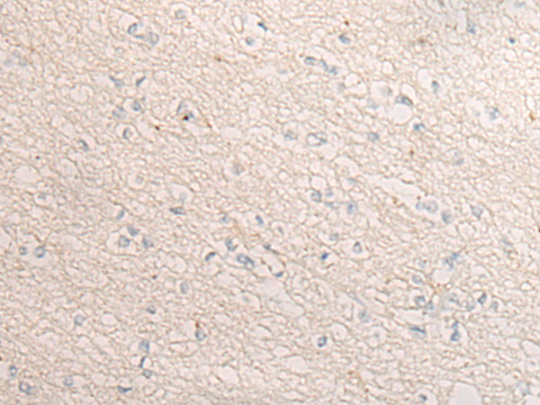 Rabbit Polyclonal Antibody to DIXDC1