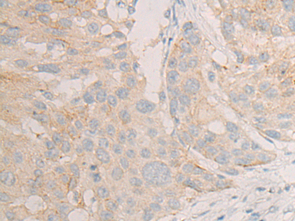 Rabbit Polyclonal Antibody to DLEC1