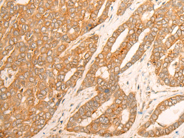 Rabbit Polyclonal Antibody to DLGAP4