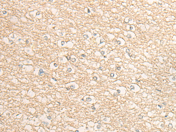 Rabbit Polyclonal Antibody to DMGDH