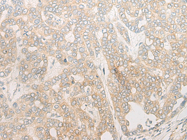 Rabbit Polyclonal Antibody to POLG
