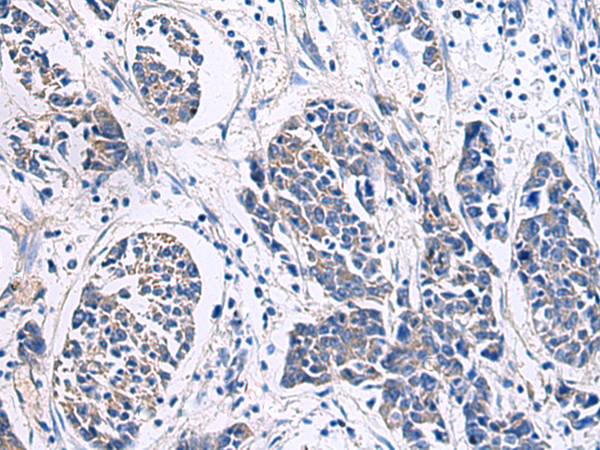 Rabbit Polyclonal Antibody to POLQ