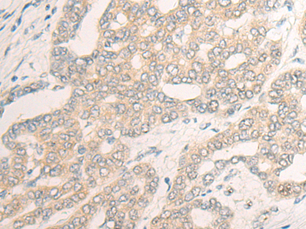 Rabbit Polyclonal Antibody to DNAJB4