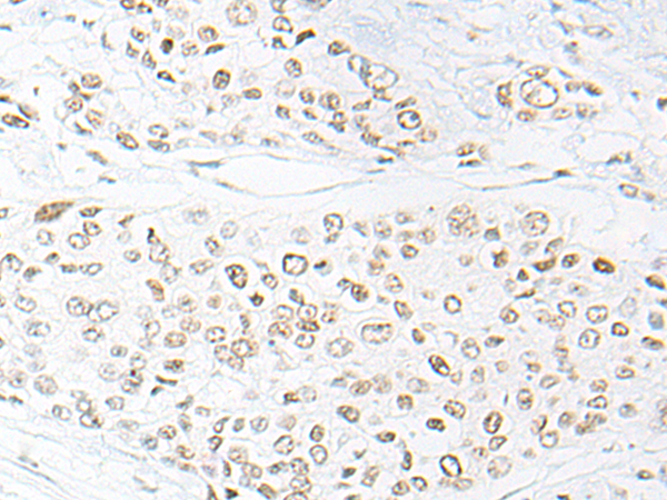 Rabbit Polyclonal Antibody to DNAJC9