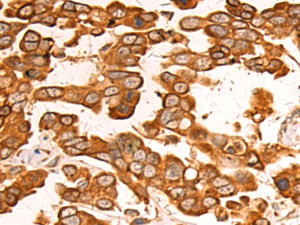 Rabbit Polyclonal Antibody to DND1