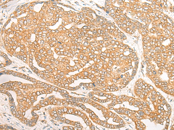 Rabbit Polyclonal Antibody to DOC2B