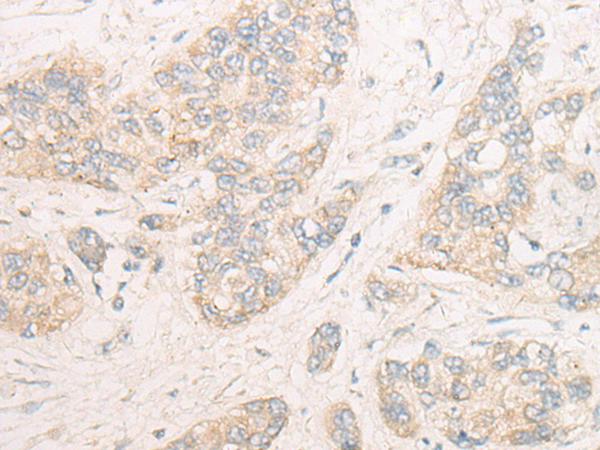 Rabbit Polyclonal Antibody to DOCK9