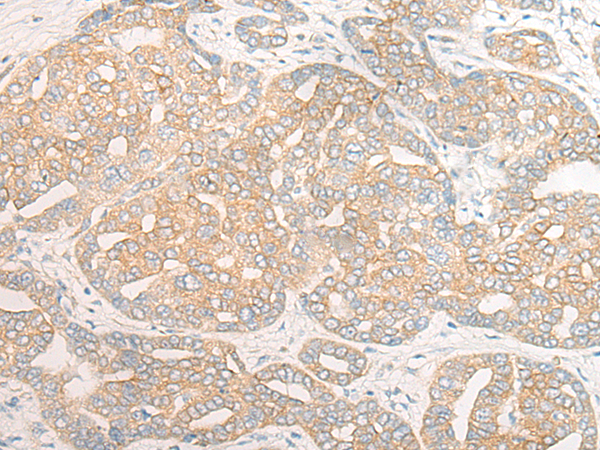 Rabbit Polyclonal Antibody to DOCK11