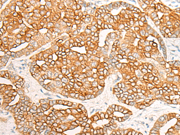 Rabbit Polyclonal Antibody to RNF19A
