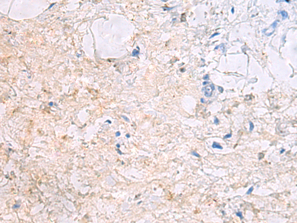 Rabbit Polyclonal Antibody to DPCD