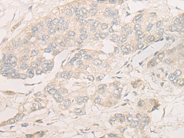 Rabbit Polyclonal Antibody to DPP9