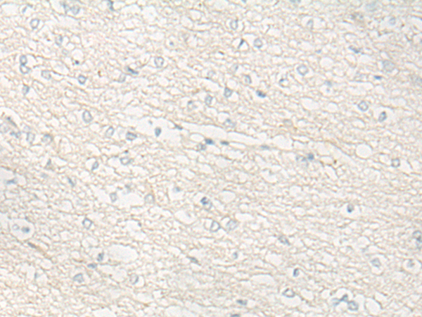 Rabbit Polyclonal Antibody to DUOX2