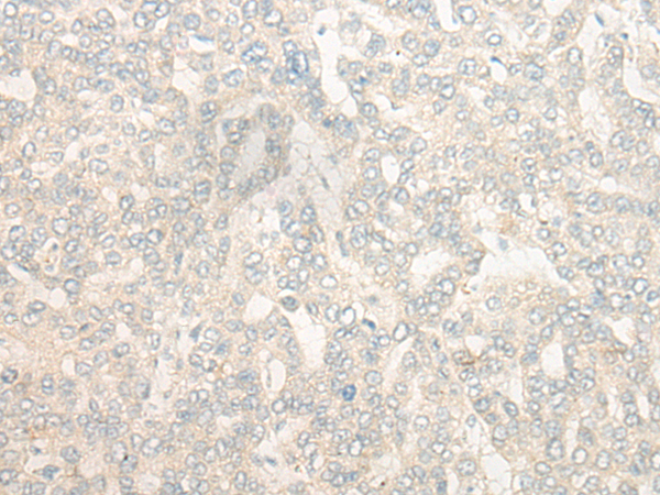 Rabbit Polyclonal Antibody to DUSP27