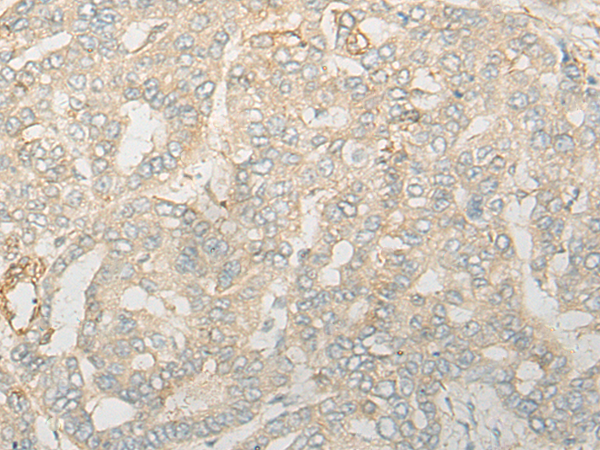 Rabbit Polyclonal Antibody to CNOT6