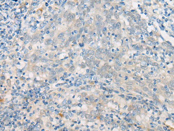 Rabbit Polyclonal Antibody to EPB41L4B