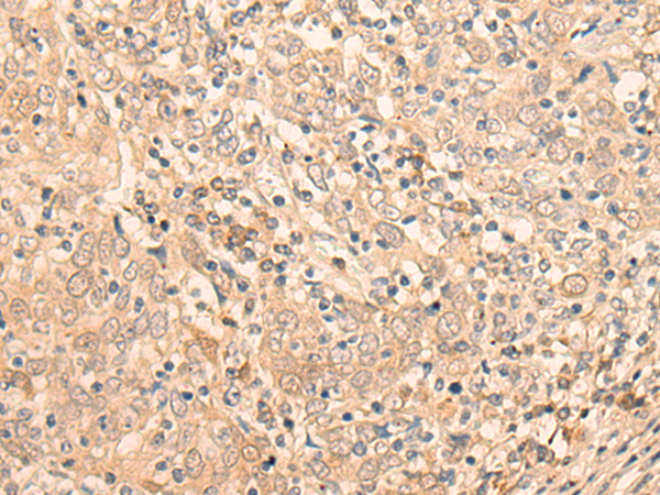 Rabbit Polyclonal Antibody to EIF2B5