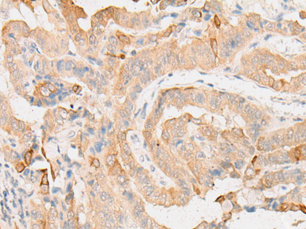 Rabbit Polyclonal Antibody to EIF2D