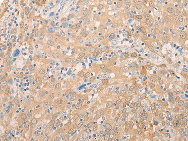 Rabbit Polyclonal Antibody to EIF3B