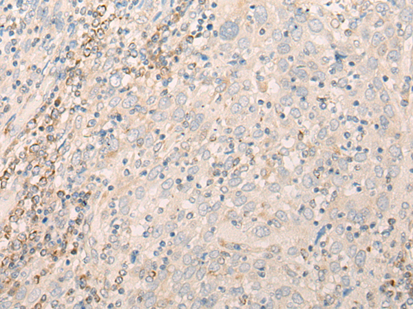 Rabbit Polyclonal Antibody to EIF3J