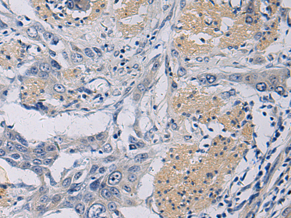 Rabbit Polyclonal Antibody to KLF1