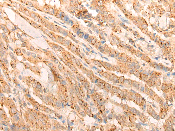Rabbit Polyclonal Antibody to ELANE