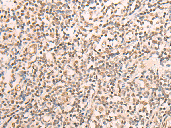 Rabbit Polyclonal Antibody to CELF2