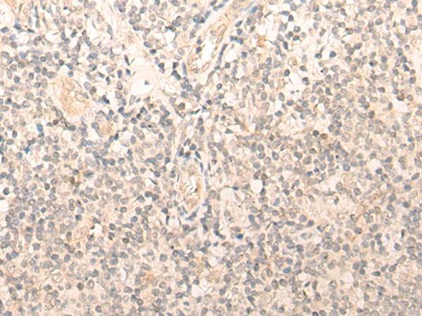 Rabbit Polyclonal Antibody to ELL2