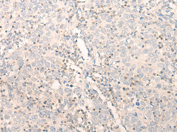 Rabbit Polyclonal Antibody to ELP4