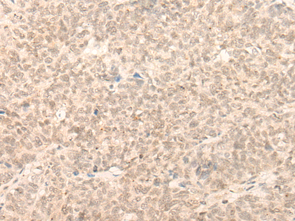 Rabbit Polyclonal Antibody to AHCTF1