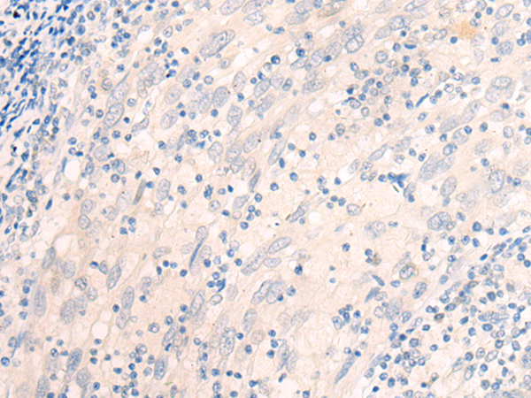 Rabbit Polyclonal Antibody to EME2