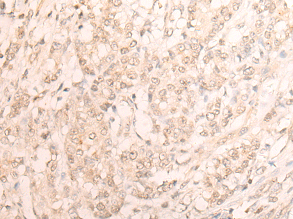 Rabbit Polyclonal Antibody to EMSY