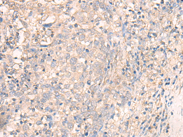 Rabbit Polyclonal Antibody to TMEM45A