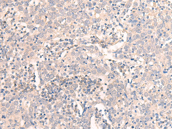 Rabbit Polyclonal Antibody to EMX1