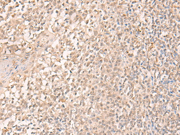 Rabbit Polyclonal Antibody to EMX2