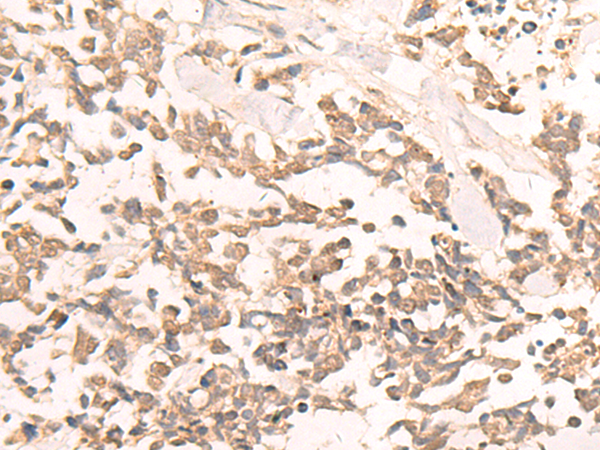 Rabbit Polyclonal Antibody to EN2