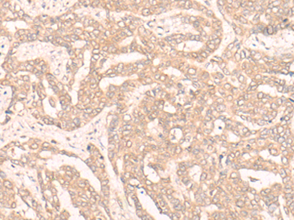 Rabbit Polyclonal Antibody to ENOSF1