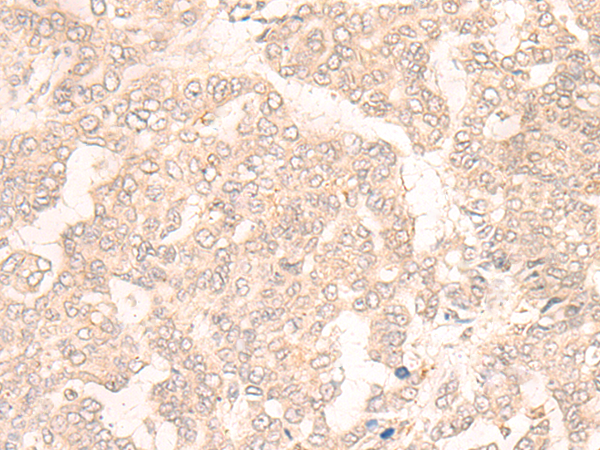 Rabbit Polyclonal Antibody to SLC29A2