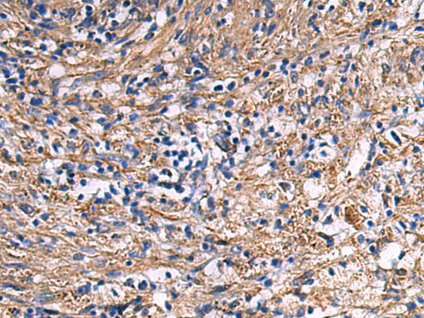 Rabbit Polyclonal Antibody to EPB41L2