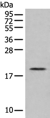 Rabbit Polyclonal Antibody to EFNA2