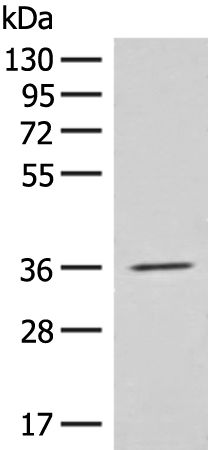 Rabbit Polyclonal Antibody to EPSTI1