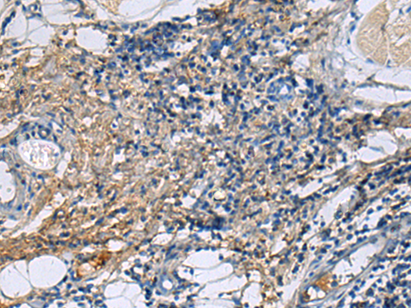 Rabbit Polyclonal Antibody to PROC