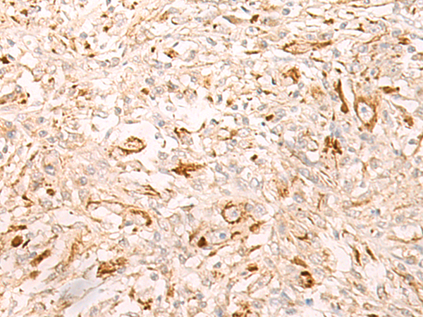 Rabbit Polyclonal Antibody to IL34