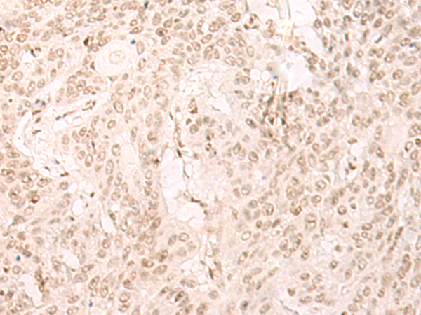 Rabbit Polyclonal Antibody to IL24