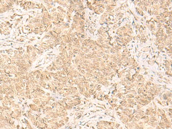 Rabbit Polyclonal Antibody to IL32