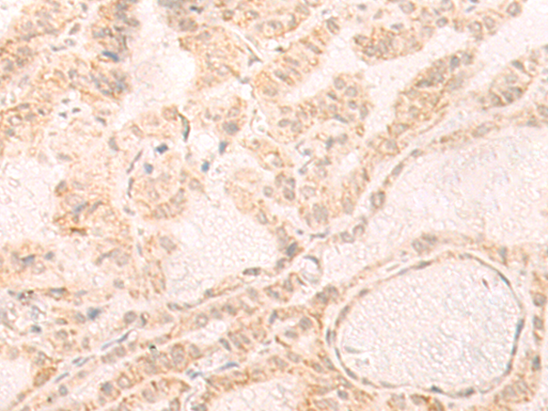 Rabbit Polyclonal Antibody to IL33