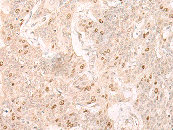 Rabbit Polyclonal Antibody to IL7