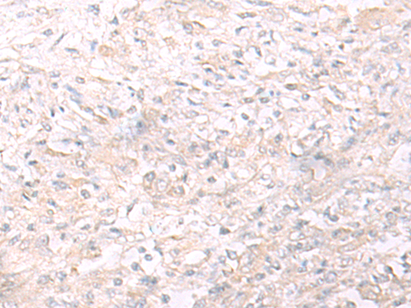 Rabbit Polyclonal Antibody to IL26